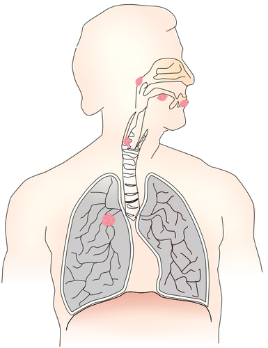 Simbol pentru cancerul pulmonar vector imagine