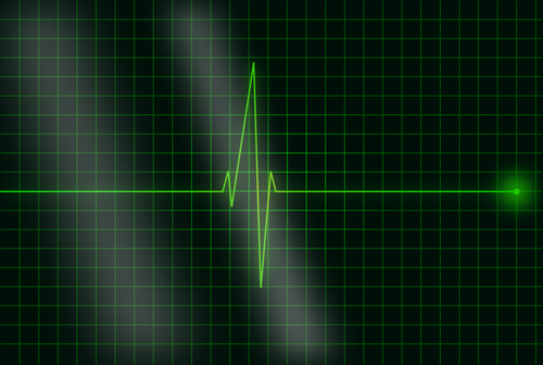 VektorovÃ½ obrÃ¡zek elektrokardiogramu