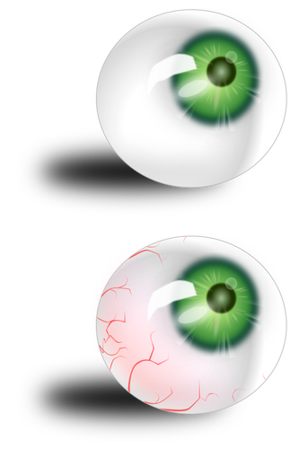 Bulbo oculare verde